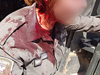 МАГАВ распространил видео с 