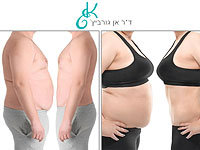 Липоксация и одновременная подтяжка кожи методом Body Tite. Видео