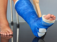 В Сплите вандал сломал ногу, оскверняя памятник герою войны 