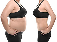 Всего за 1,5 часа лишний жир на проблемном участке исчез, а кожа подтянулась