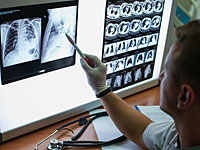 Минздрав закрыл единственное в стране отделение для больных туберкулезом