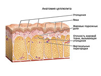 CelloTite – единственный метод, который устраняет целлюлит