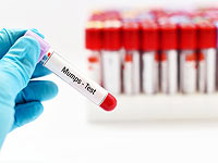 В школе в поселке Реут обнаружен случай заражения паротитом