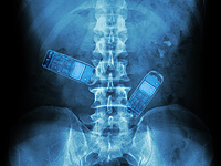 Активист НФОП, доставленный в тюрьму, пытался пронести в животе мобильные телефоны