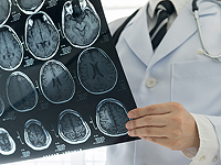 Жизнь с половиной мозга: как это возможно