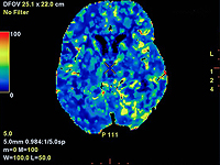 Американские ученые: алкоголь и табак ускоряют старение мозга