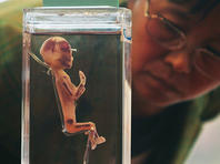 Более 2.000 зародышей найдены в гараже умершего гинеколога из Индианы