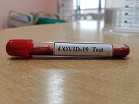 В КНР обнародован первый отчет по вирусу Covid-19: уровень смертности – 2,3%