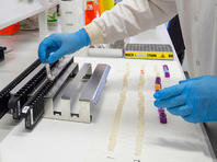 В России за сутки зафиксированы 14 новых случаев заражения коронавирусом