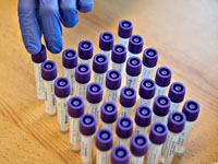 Пандемия коронавируса. Статистика заразившихся и умерших людей из мира спорта