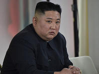 Тhe Associated Press: Ким Чен Ыну не проводили операцию на сердце, ни какую-либо иную медпроцедуру