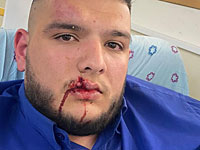 В иерусалимском Писгат Зеэве пассажир спустил питбуля на водителя автобуса