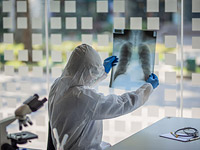 Новый метод позволит диагностировать коронавирус с помощью рентгена