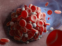 Ученые: главная опасность COVID-19  - развитие тромбоза