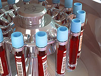 Немецкие ученые:  к тяжелой форме COVID-19 склонны обладатели II  группы крови