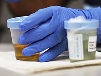 Коронавирус атакует почки: специалисты рекомендуют сдавать анализ, даже если нет симптомов