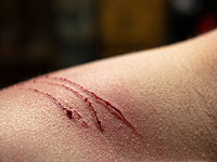 Пожилая женщина умерла после того, как кошка облизала царапину на ее теле