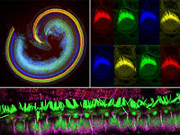 Исследователи из Тель-Авивского университета идентифицировали новые гены, вызывающие потерю слуха