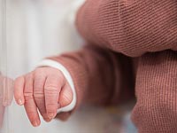 Впервые в Израиле родились сиамские близнецы, сросшиеся головами