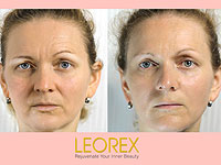 Ученые из Техниона исследовали диоксид кремния и совершили революцию в мире косметологии