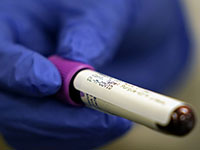 В Сингапуре родился ребенок с антителами к коронавирусу