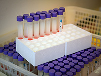 Коронавирус в Израиле: в больницах находятся 563 заболевших, 120 из них в критическом состоянии