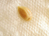 Англичанка около 60 лет прожила с апельсиновым зернышком в носу