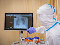 Израильское исследование: не менее трех месяцев у перенесших COVID-19 наблюдаются симптомы болезни