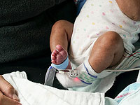 В Ираке появился на свет первый в истории мальчик с тремя половыми членами