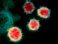 Исследование: треть переболевших коронавирусом страдает неврологическими или психологическими проблемами