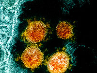 Коронавирус встраивается в геном человека?