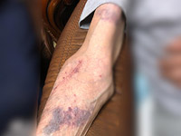 В Иерусалиме по подозрению в избиении старика задержан иностранный работник, гражданин Филиппин