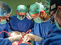 В Израиле впервые проведена операция по разделению сиамских близнецов, соединенных головами