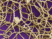 У подростка, купавшегося в источнике в Цфате, выявлен лептоспироз