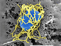 Вспышка менингококка в детском саду ХАБАДа на Кипре: один ребенок умер, еще одна в тяжелом состоянии