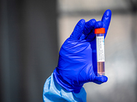 Коронавирус в Израиле: минздрав объявил о резком сокращении числа зараженных