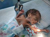 Конференция по помощи Йемену: половина населения страны голодает