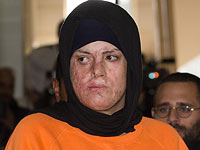 ШАБАС рассмотрит оплату пластической операции