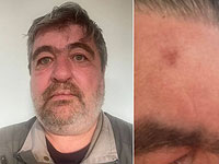 Тележурналист Сергей Гранкин был легко ранен в результате 