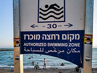 Паразитарные заболевания глаз диагностированы у 40 израильтян, все они отдыхали на Кинерете