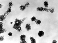 Минздрав Израиля зарегистрировал рост заболеваемости ветряной оспой