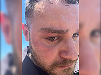 Пострадавший полицейский