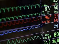 Израильский стартап, разработавший ИИ-программу диагностики сердечных заболеваний, получил лицензию FDA