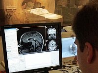 Врачи, искавшие причину головных болей пациента, нашли в его мозгу палочки для еды