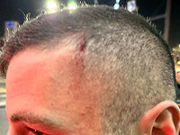 Три года со дня гибели Ахувии Сандака: столкновения поселенческой молодежи с полицией в Иерусалиме