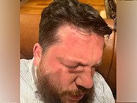 В Вильнюсе неизвестные напали с молотком на бывшего главу штабов Навального Леонида Волкова