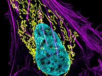 У водорослей нашли нитропласты – органеллы, которые позволяют им 