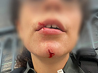 Столкновения между полицией и