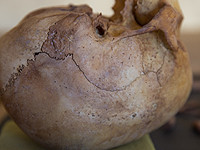 Новое исследование: в Древнем Египте пытались лечить рак