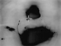 ВВС ЦАХАЛа атаковали пусковые установки 